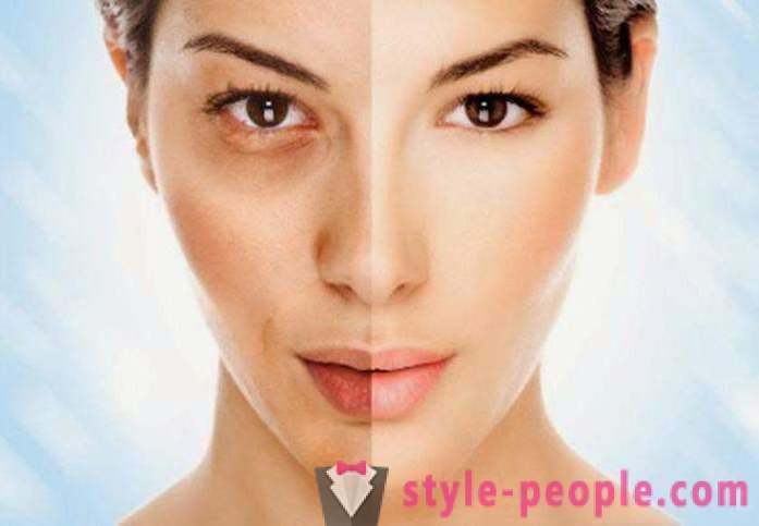 Hollywood Peeling: types of procedures and results