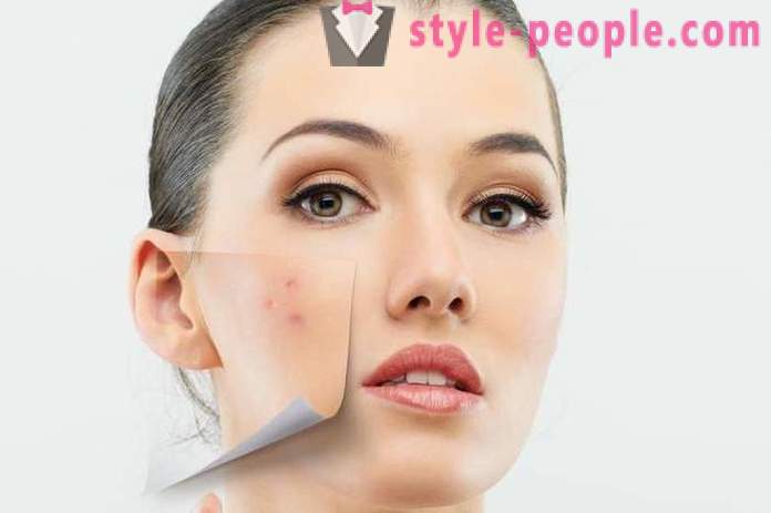 Why can not squeeze the pimples on your face?