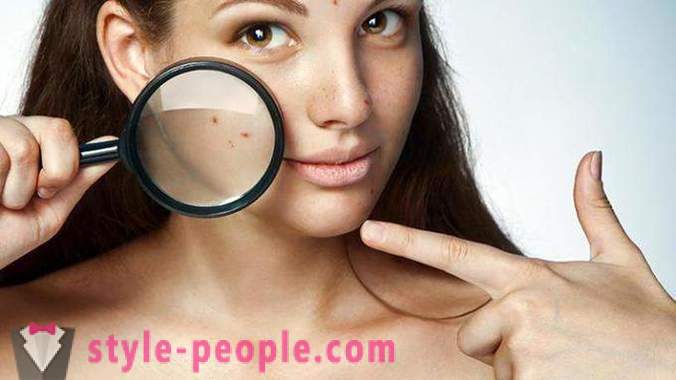 Why do I get pimples on the face in adults?
