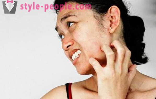 Irritation - it ... Causes and treatment of skin irritation