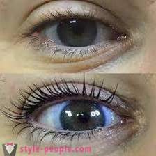 What is Botox eyelashes? Photos before and after, especially procedures