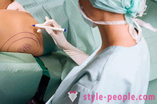 Plastic surgeons destroy stereotypes about their work