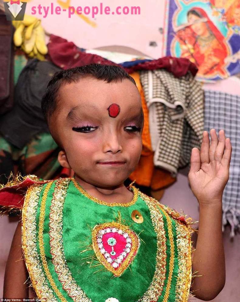 The Indian village is worshiped boy with a deformed head as a god Ganesha