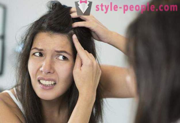 Effective remedy for dandruff at home. How to get rid of dandruff