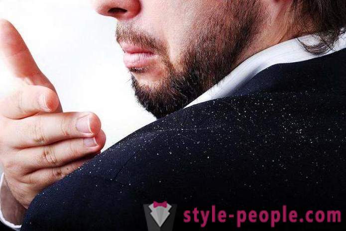 Effective remedy for dandruff at home. How to get rid of dandruff