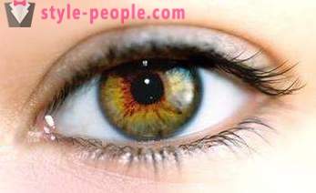 Swamp eye color. What determines the color of the human eye?