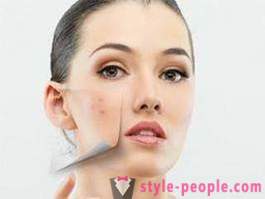 Cryo face with liquid nitrogen: reviews and description of the procedure