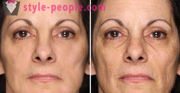 How to tighten oval face at home? Tighten facial contours: exercise, masks