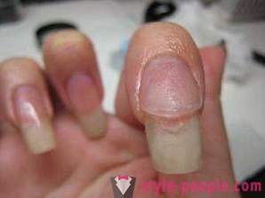 How to remove acrylic nails at home? Removing acrylic nails: reviews