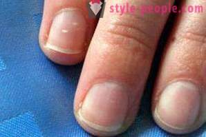 Which could mean a white spot on the nail?