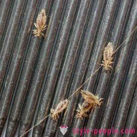 Where are head lice? Treatment and prevention of head lice
